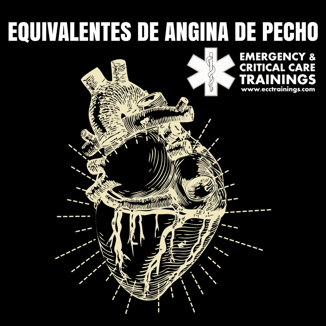 equivalente de dolor de pecho